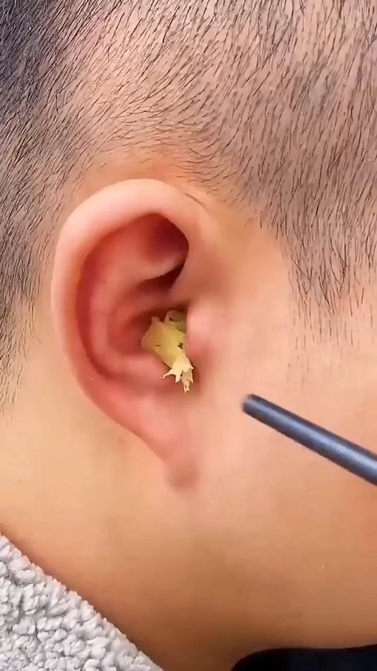 Ear Wax Cleaning Kit, 6 Pcs Ear Pick Tools, Wax Removal Kit, Ear Cleaning Tool Set, Spring Earwax Cleaner Tool for Children and Adult Multicolor